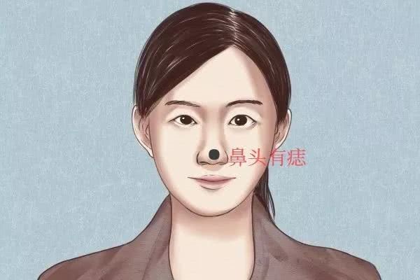 痣相大全：男右脖子有痣_男子脖子右侧有痣好吗_男脖子右边有痣代表什么意思