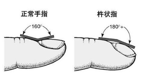 手指长度看手相_手相图解手指长短算命_手指长度相学图解