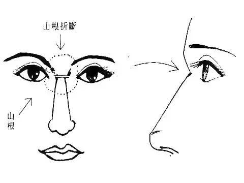 尖嘴巴的面相分析_嘴巴尖的面相学图解女_女面相痣图解